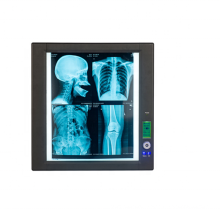 Single panel x-ray film scanner led negatoscope